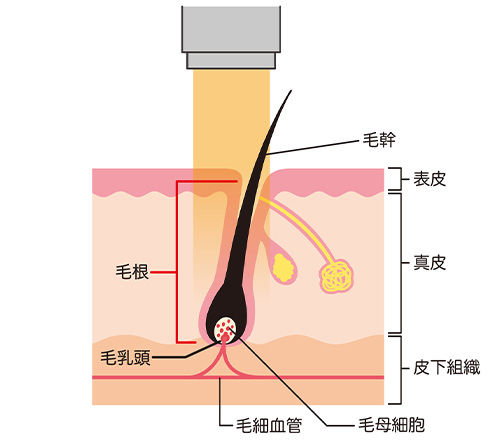 宮城県仙台市・南仙台で医療メンズ脱毛・ヒゲ脱毛を提供しているおくぐち皮ふ科クリニックのエステ脱毛の医療脱毛と毛周期の説明画像