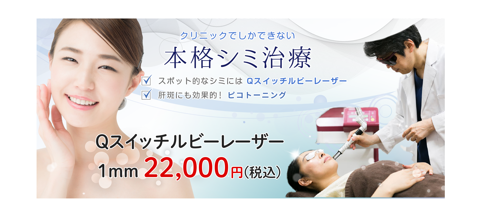 シミレーザー治療