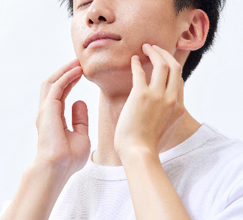 メンズひげ脱毛